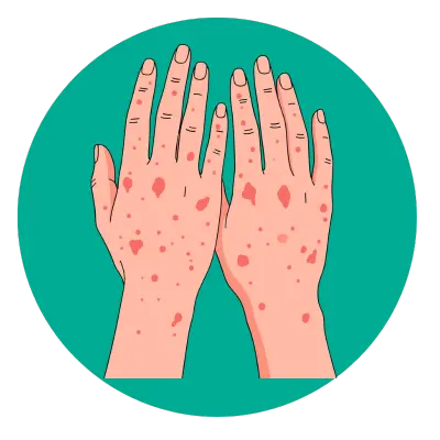 Skin Diseases Treatment