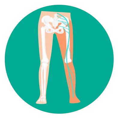 Spondylosis Treatment